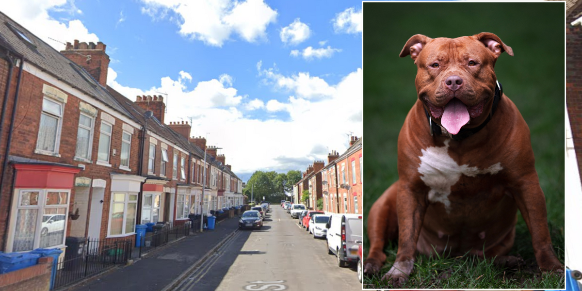 XL Bully leaves 5 year-old boy with serious head injuries
after vicious attack